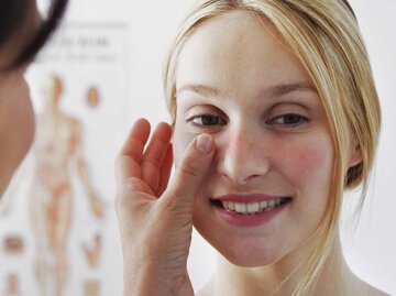 Frau mit Rötungen im Gesicht lächelt | © Shutterstock/Image Point Fr 