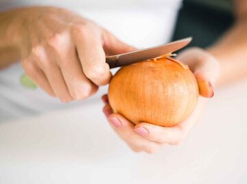 Frau schält eine braune Zwiebel. | © Adobe Stock/anastasiapelikh